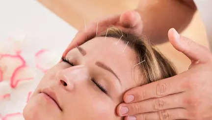 Acupunctura în sarcină 