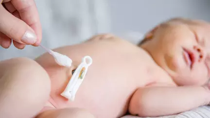 Cum îngrijești cordonul omblical al nou-născutului