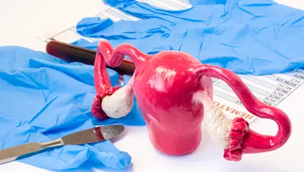 Ce trebuie să ştii despre epiziotomie