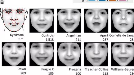 Programul de computer care diagnostichează boli genetice rare