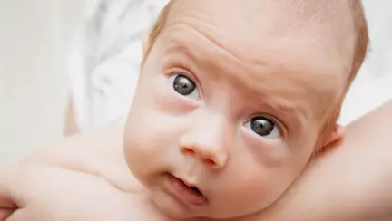 Glaucom la bebeluși - cum îl depistezi din timp