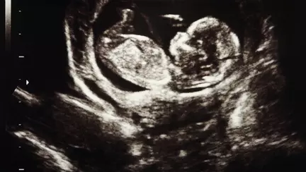 Sarcina oprită în evoluţie – ce trebuie să ştii