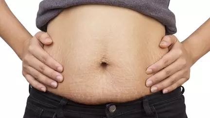 Scrisoarea deschisa a mamei cu vergeturi