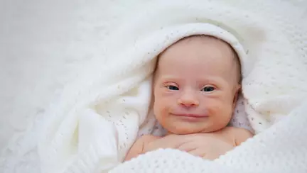 Bebelusul cu Sindrom Down care a cucerit internetul