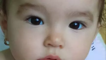 Un bebeluș din Vâlcea, în moarte cerebrală. Mama spune că e de la fructe. Care este explicația medicilor