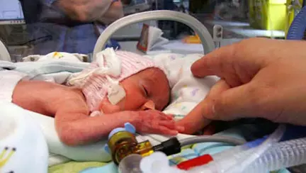 Povestea bebelusului de 450g care a sfidat toate sansele