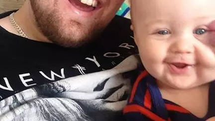 Ce îi spune o mamă băiețelului ei când oamenii se holbează la el din cauza unui semn din naștere