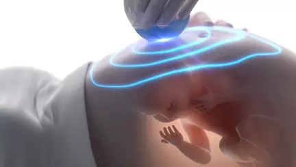 Bebelusul care canta in burtica  - VIDEO