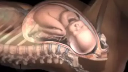 Nașterea naturală: imagini și explicații privind transformarea corpului unei femei și intensitatea durerii| VIDEO
