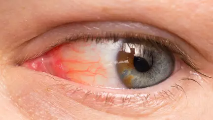 A ramas aproape orb din cauza unei jucarii