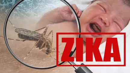 S-a nascut primul bebelus din Europa infectat cu virsului Zika