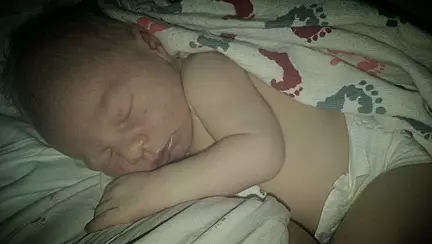 Cezariana nu este "calea usoara" - Postarea unei mamici te va lasa fara cuvinte