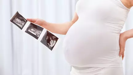 Ecografia de sarcina care a devenit virala