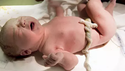 Caz uluitor. O femeie a născut la 7 luni după ce medicii i-au spus că a pierdut sarcina