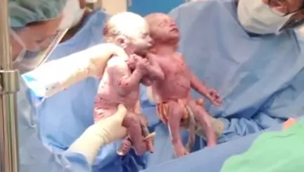 Gemenele mono mono, care s-au luat de mânuță imediat după naștere, sunt și acum nedespărțite | VIDEO