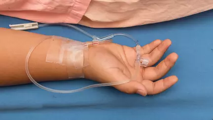 Al treilea deces in Arad din cauza rujeolei