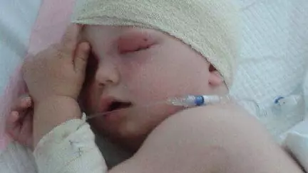 Coșmarul oricărui părinte: un copil care a căzut de pe canapea, la un pas de moarte