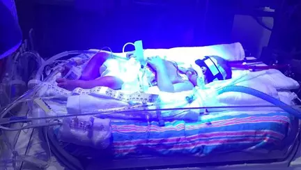 Doi părinți și-au pus copilul sănătos lângă fratele lui geamăn, aflat în stare gravă. Ce au văzut i-a făcut să plângă imediat