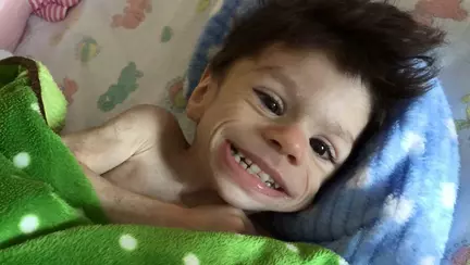 Schimbarea incredibilă a unui copil orfan adoptat din Bulgaria. Micuțul era la un pas de moarte