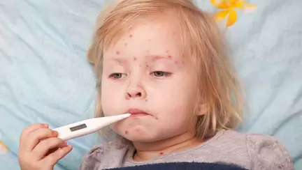 UPDATE | Încă un bebeluș de numai cinci luni a murit în spital din cauza rujeolei