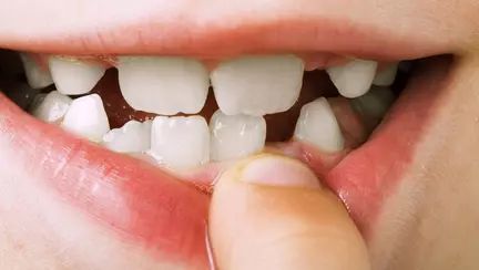 Un baietel adorabil plange dupa dintisorul sau de lapte