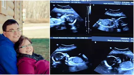 Au avut un soc cand, la ecografie, au aflat ca vor avea 4 gemeni identici