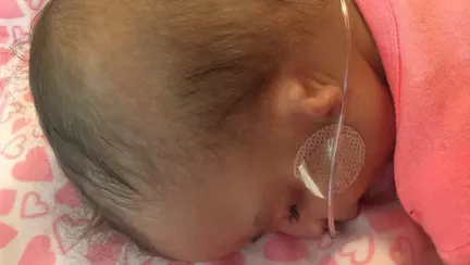 Parintii adoptivi au lasat-o in spital cand au vazut cum arata