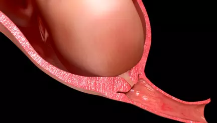 Dopul gelatinos: Cum arata, ce este, cand si de ce il pierzi