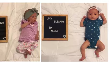 Impactul pe care limba legata o poate avea asupra greutatii bebelusului