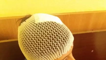 Ce am facut cand copilul meu si-a spart capul