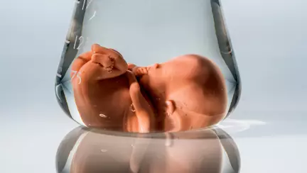 Excesul de lichid amniotic (polihidraminoza) - Simptome, cauze, precautii