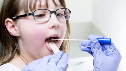 Exudatul faringian - Cand este necesar si cand se efectueaza