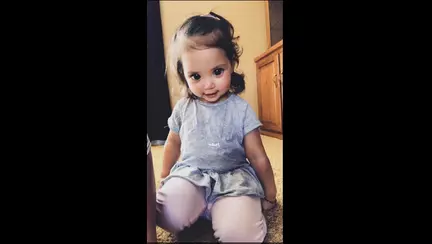 Toti se opresc sa ii admire ochii mari, insa putini stiu adevarul trist din spatele lor