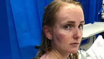 Aceasta mama si-a protejat copilul cu pretul propriului sau corp