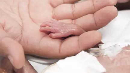 Copilul miracol: cum arata azi cel mai mic prematur din lume