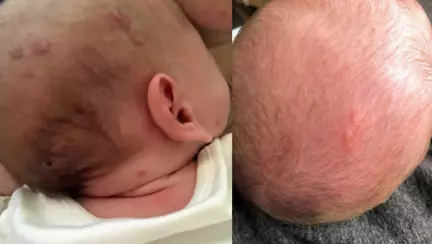 Boala care era cat pe ce sa ii omoare bebelusul de 2 saptamani