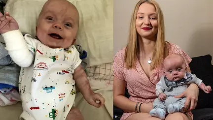 Copilul născut fără piele a împlinit șase luni. Cum arată micuțul Kaiden