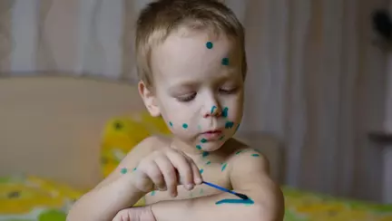 Care sunt diferențele între principalele boli ale copilăriei