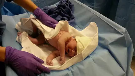 Drobeta-Turnu Severin: Medic, acuzat că ar fi rănit un nou-năsut cu bisturiul în timpul operației de cezariană