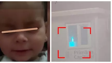 O fetiță s-a ales cu corneea arsă, după ce a fost expusă la raze UV în Spitalul de copii "Victor Gomoiu"