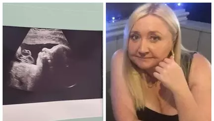 O femeie a avut șocul vieții când a văzut ecografia copilului din pântec: "Primul meu gând a fost că acolo este ceva care arată ca o broască"