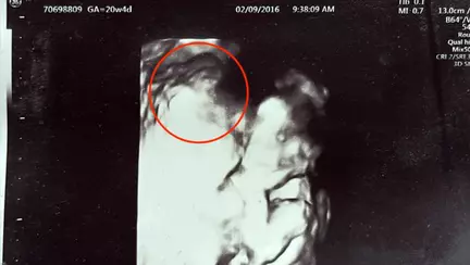 O mamă spune că a văzut-o pe Fecioara Maria ținându-i fiul, la scurt timp după ce a aflat că fătul i-a murit