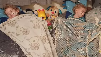 Doi băieței, gemeni, se luptă pentru viețile lor după ce au fost diagnosticați cu o afecțiune extrem de rară