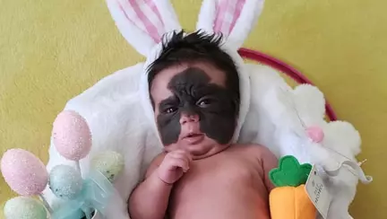 Cum arată astăzi fetița care s-a născut cu "masca lui Batman". Transformarea micuței Luna este chiar un miracol!