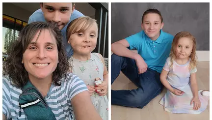 O fetiță și-a pierdut urechile și buza inferioară din cauza unui "semn de naștere"