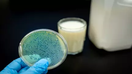 Probioticele: Soluția pentru constipație