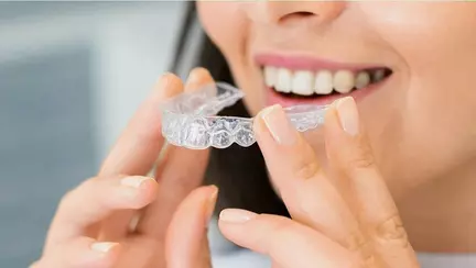 Din ce material sunt realizate gutierele unui aparat dentar Invisalign? Tipuri de dispozitive