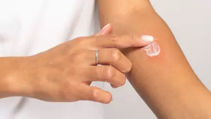 Cele mai bune soluții pentru ameliorarea disconfortului cauzat de înțepăturile de insecte