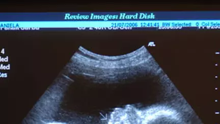 Sarcina ta: fa-ti analizele