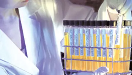 Toxoplasmoza - infectie parazitara